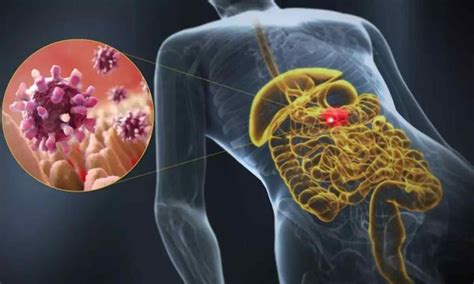 Gastroenteritis por qué da