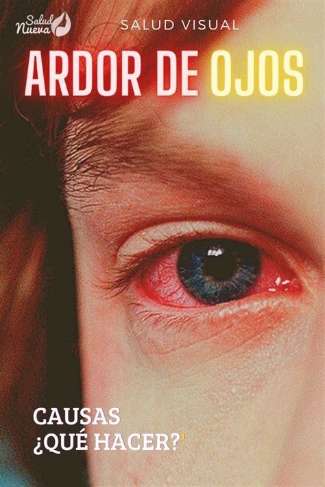 Por qué arden los ojos