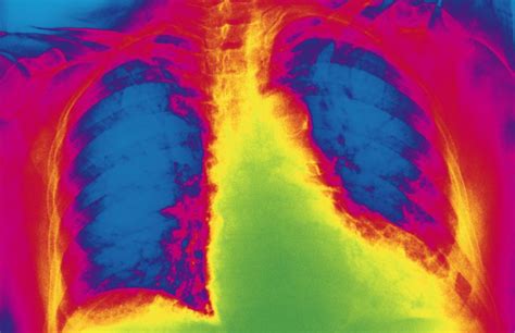 Por qué crece el corazón