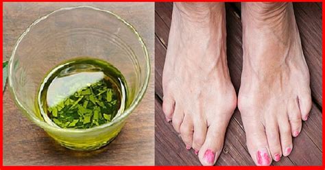 Soluciones para juanetes en los pies