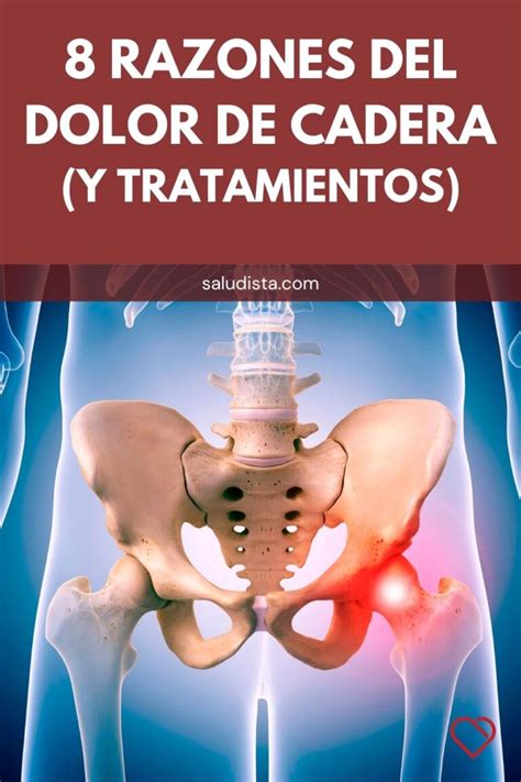 Dolor en cadera izquierda