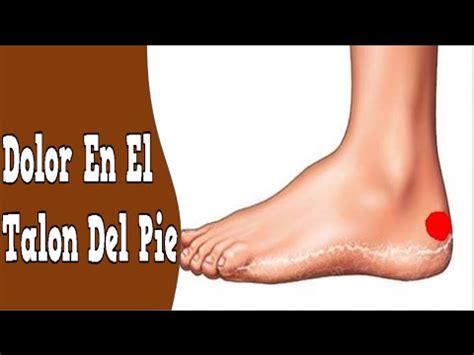 Dolor en el talon del pie
