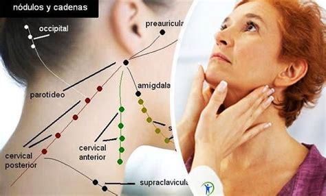 Dolor en ganglios del cuello