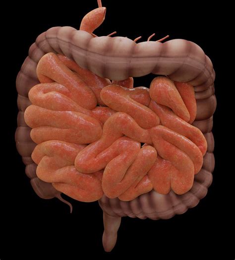 Reconexión de intestino preguntas y respuestas
